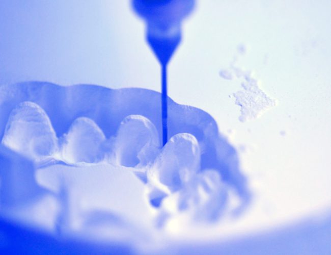 Dental milling machine carving out shape of human teeth close-up. Modern medical technologies. Concept of 4.0 industrial revolution